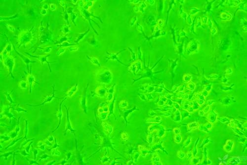 生物学家报告了计算细胞 基因的终生能量需求的方法