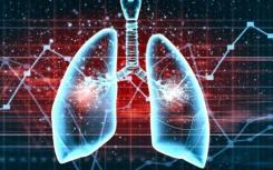 用新工具快速测量肺癌的检查点抑制剂水平