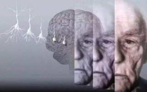 阿尔茨海默氏症的认知功能障碍与凝血因子有关