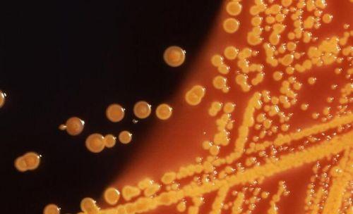 可翻转的DNA开关有助于细菌抵抗抗生素