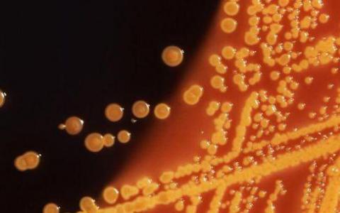 可翻转的DNA开关有助于细菌抵抗抗生素