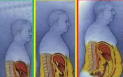 通过靶向腰臀比基因进展脂肪分布遗传学