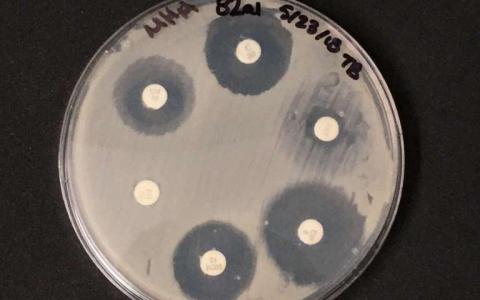 抗菌化学物质与尘埃中的抗生素抗性基因相关联