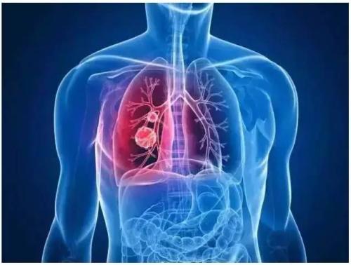肺多能干细胞参与肺脏再生