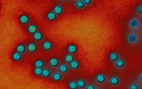物理学家确定致命细菌用来抵御抗生素的简单机制