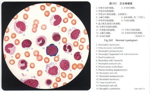 新的细胞图谱可以更深入地了解致盲疾病