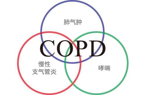 COPD抗炎策略中靶向炎症介质的小分子药物