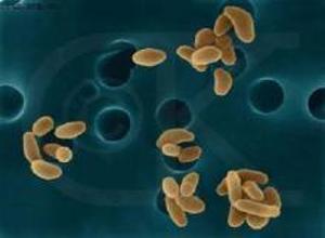Tularemia细菌冬眠 可以追踪恐怖袭击