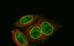 如何阻止HIV DNA进入细胞核