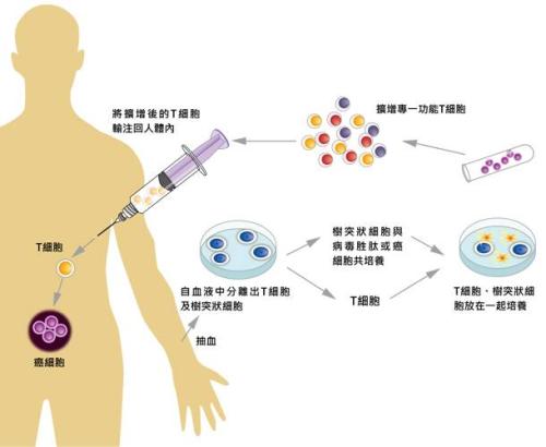 给T细胞解乏 CAR-T疗法进攻实体瘤