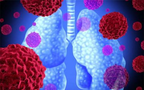 新研究揭示治疗肺纤维化的关键时间窗口