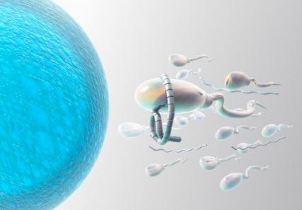 一种新型微流体设备能改善对精子质量的筛选