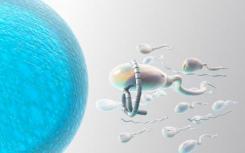 一种新型微流体设备能改善对精子质量的筛选
