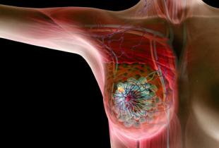 有效的乳腺癌联合治疗针对BACH1和线粒体代谢