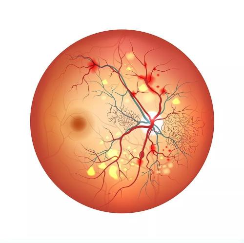 迷你脑与视网膜色素细胞创建