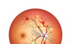 迷你脑与视网膜色素细胞创建