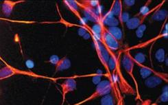 蛋白质Matrin-3决定了神经干细胞在大脑发育过程中的命运