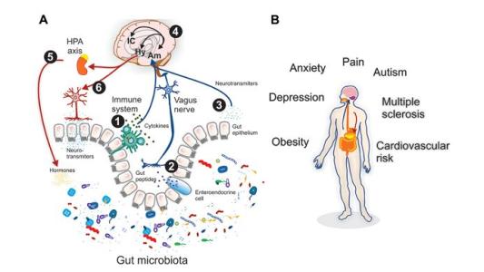 来自全球人类肠道微生物组的未培养基因组的新见解