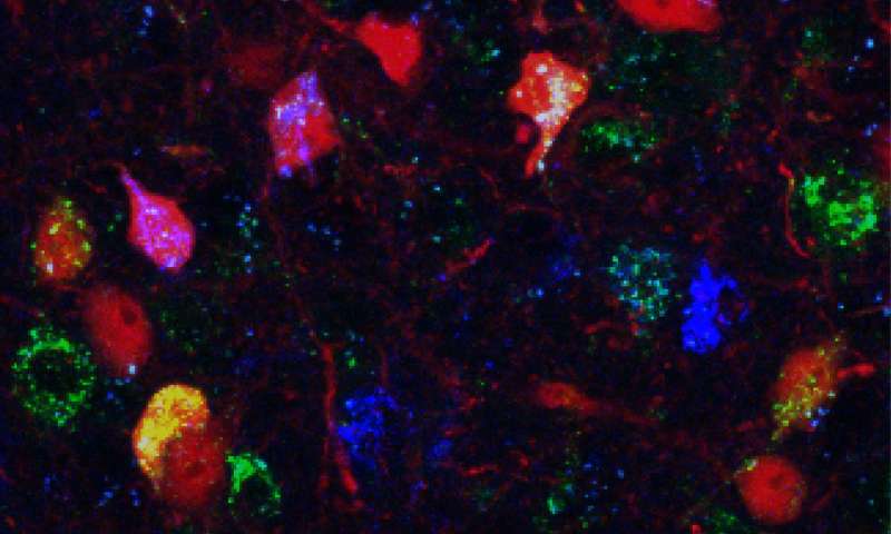 分子和细胞生物学家获得了Eppendorf和神经生物学科学奖