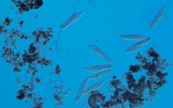生物多样性也可能破坏生态系统的稳定