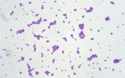 研究人员发现了什么肺炎球菌会让你生病