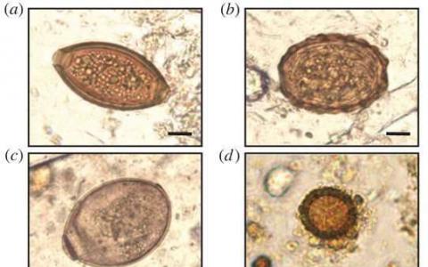 来自中世纪厕所的寄生虫揭开了人类历史的秘密