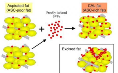 与较胖脂肪细胞相关的低铜水平