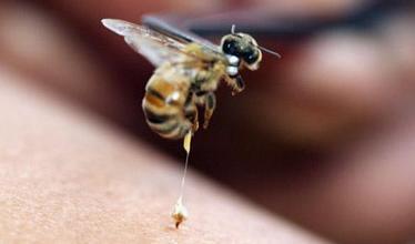黄蜂和蜜蜂毒刺设计如何有助于缓解疼痛