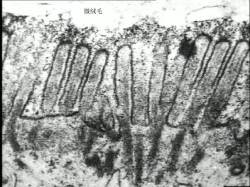 微绒毛是如何形成的