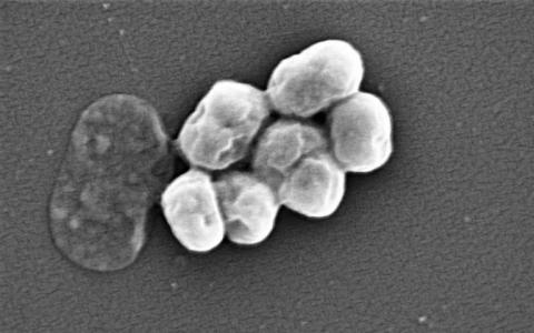 研究表明细菌会改变其表面以增加抗生素抗性
