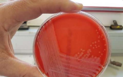 新的细菌菌株以康沃尔发现命名