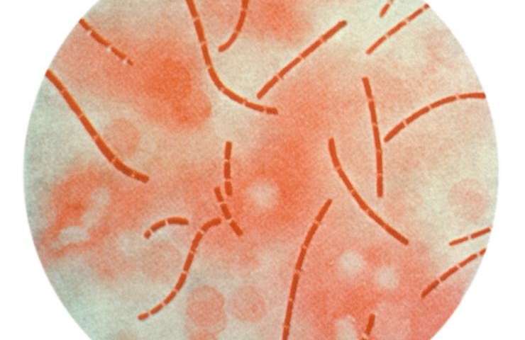 412株炭疽菌的基因组研究提供了新的毒力线索