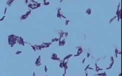 对Myxococcus xanthus中Pom簇动力学的调控