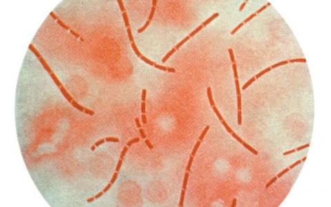 412株炭疽菌的基因组研究提供了新的毒力线索