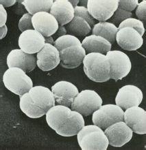 巧妙定位的表面蛋白质使一些肺炎球菌菌株特别危险