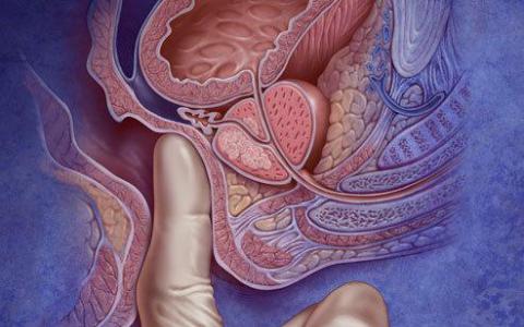 前列腺癌喷出邻近肿瘤促进蛋白质