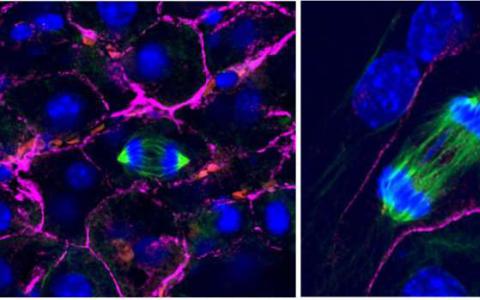 用于分割染色体的3-D细胞环境关键发现可以解释癌症的标志