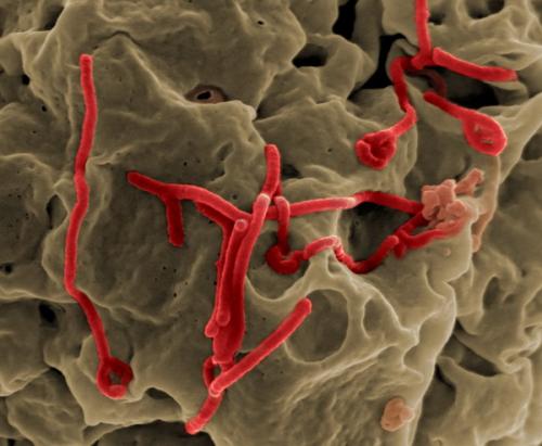 研究人员揭开了埃博拉病毒 宿主细胞粘附的生物力学特征