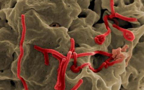 研究人员揭开了埃博拉病毒 宿主细胞粘附的生物力学特征