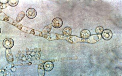 研究人员利用细菌治疗真菌感染