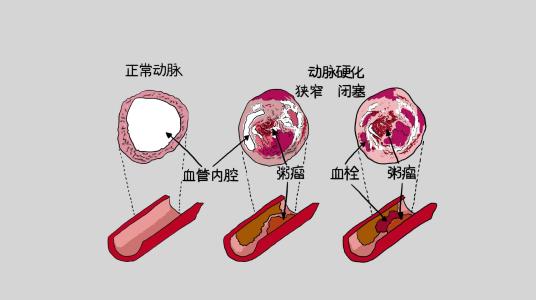 研究重点需要使人口水平的遗传数据多样化以便更好地预测疾病