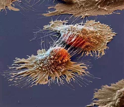 光声显微镜帮助科学家更好地检查癌细胞