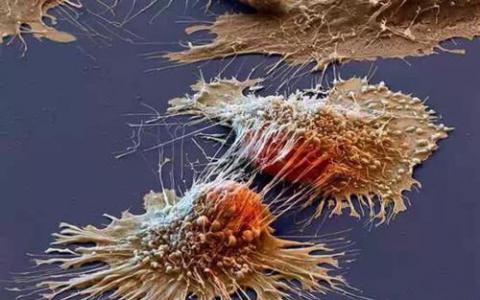 光声显微镜帮助科学家更好地检查癌细胞