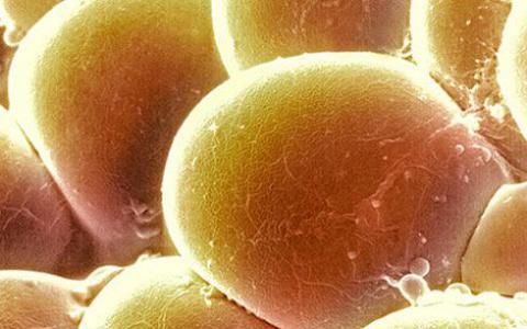 脂肪细胞激素保护妇女免受肝癌
