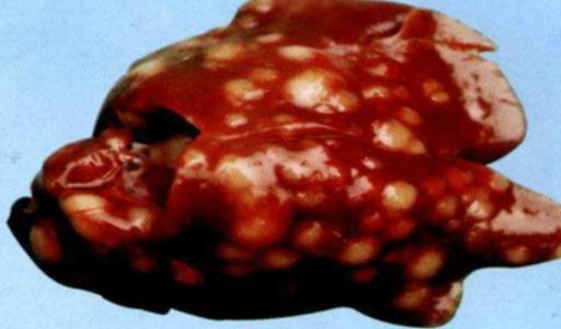 p38γ对细胞周期进展和肝脏肿瘤发生至关重要