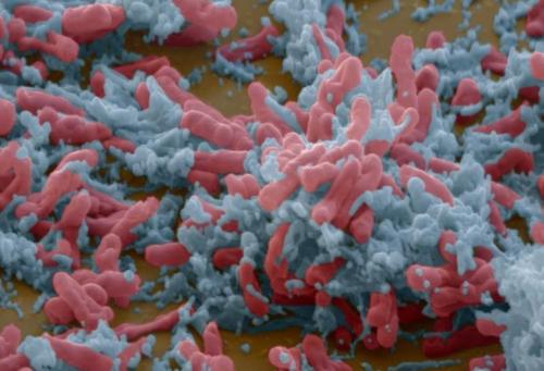 研究发现适应肺部的细菌更容易被抗生素杀死