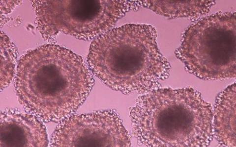 卵母细胞因子可以重编程成人细胞