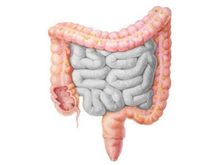 研究发现罕见的肠道状况更可预测个体的基因组成