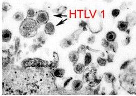 致癌病毒HTLV-1改变DNA环以“影响成千上万的基因”