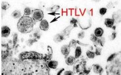 致癌病毒HTLV-1改变DNA环以“影响成千上万的基因”